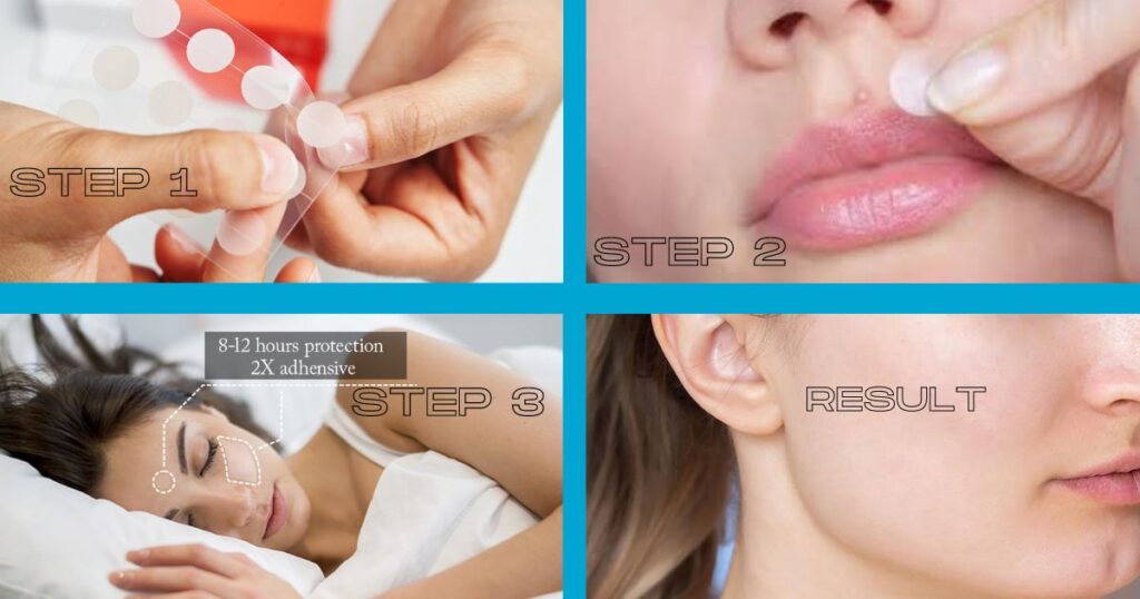 acne patches using steps