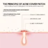 Overnight acne patches for reducing pimples and acne scars