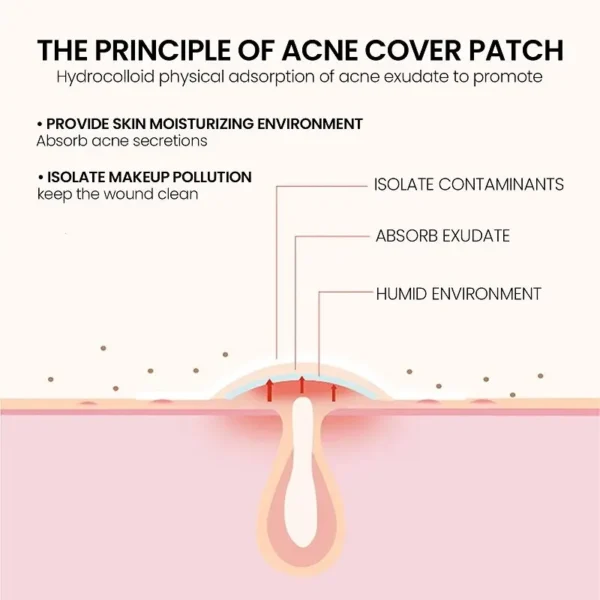 Overnight acne patches for reducing pimples and acne scars
