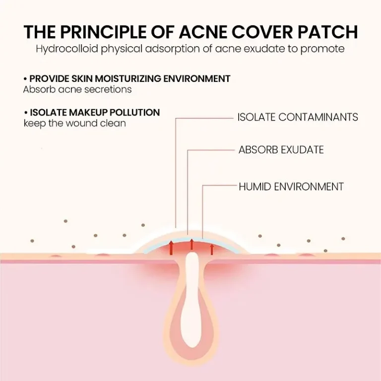Overnight acne patches for reducing pimples and acne scars