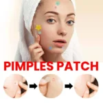 200PCS acne patch set – clear skin facial care product