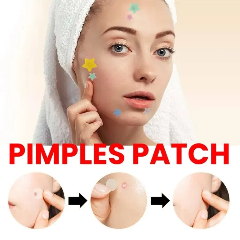200PCS acne patch set – clear skin facial care product