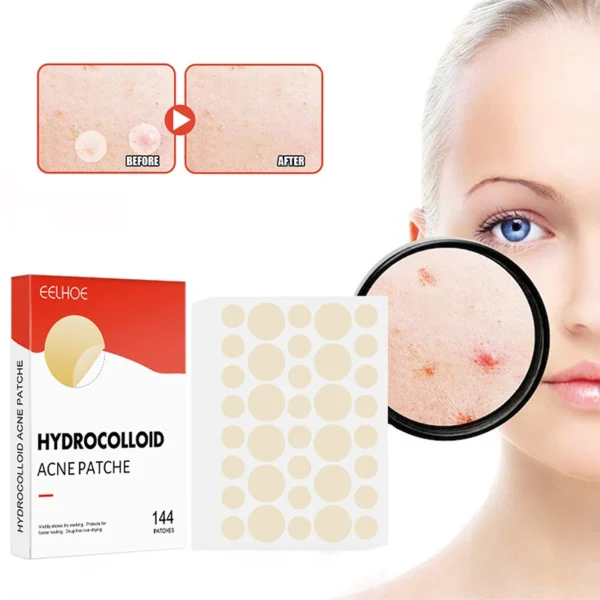 Acne Pimple Patches Set