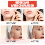 240pcs Premium Heart & Star Shaped Pimple Patches