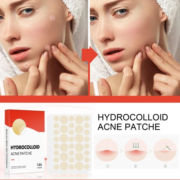Acne Pimple Patches Set