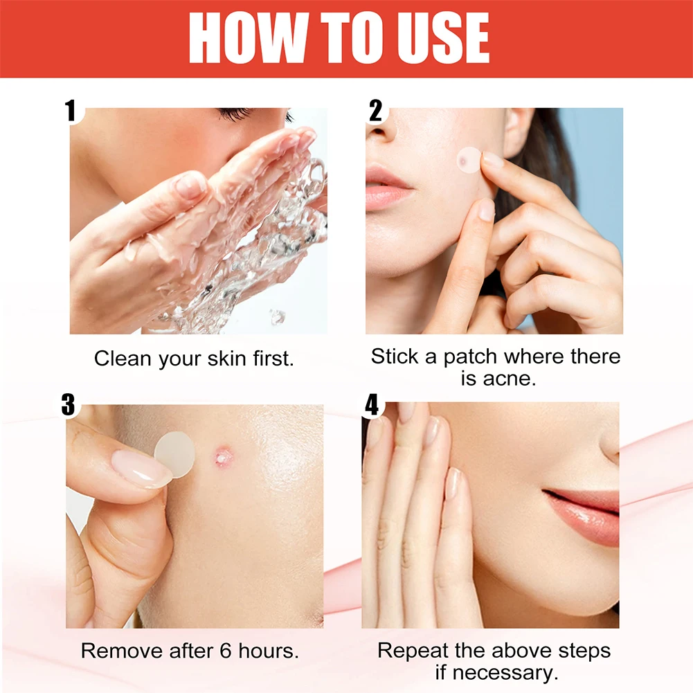 Acne Pimple Patches Set