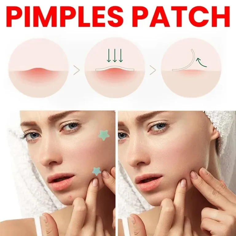 hin hydrocolloid patches for acne – close-up image of product texture
