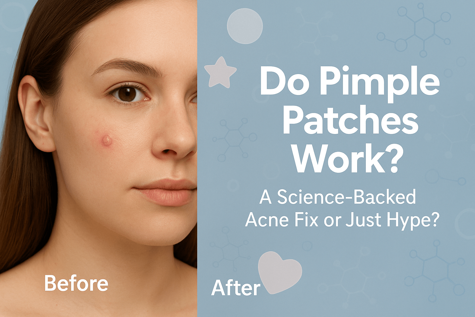 Do Pimple Patches Actually Work